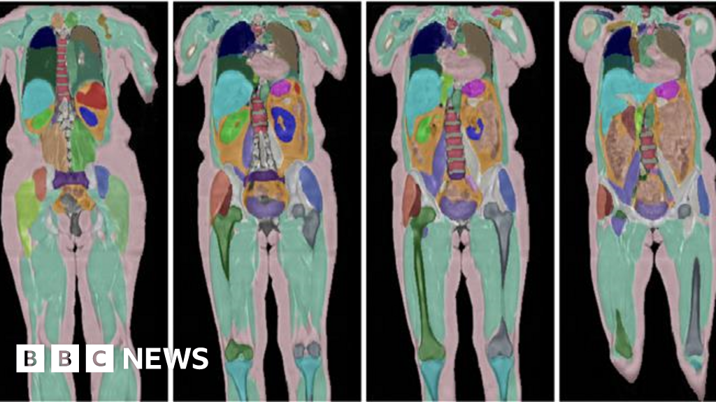 Featured image for Largest Human Imaging Project Reaches 100,000 Volunteers, Aiming to Transform Disease Detection
