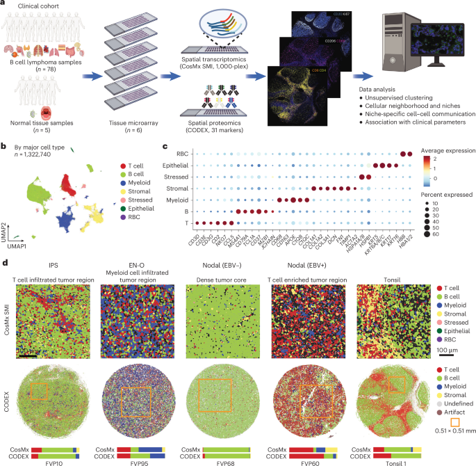 Featured image for Mapping Tumor Immune Niches in Diffuse Large B Cell Lymphoma