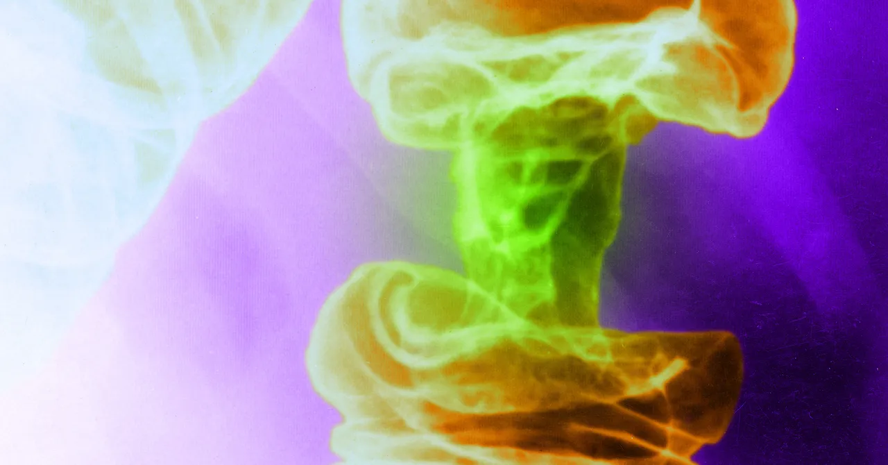 Featured image for Light-Based Cancer Therapy Targets Tumors While Protecting Healthy Cells