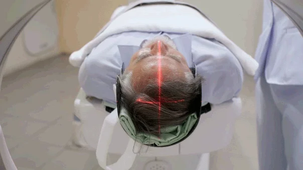 Common Brain Vessel Condition May Quadruple Dementia Risk in Seniors, Large Study Shows