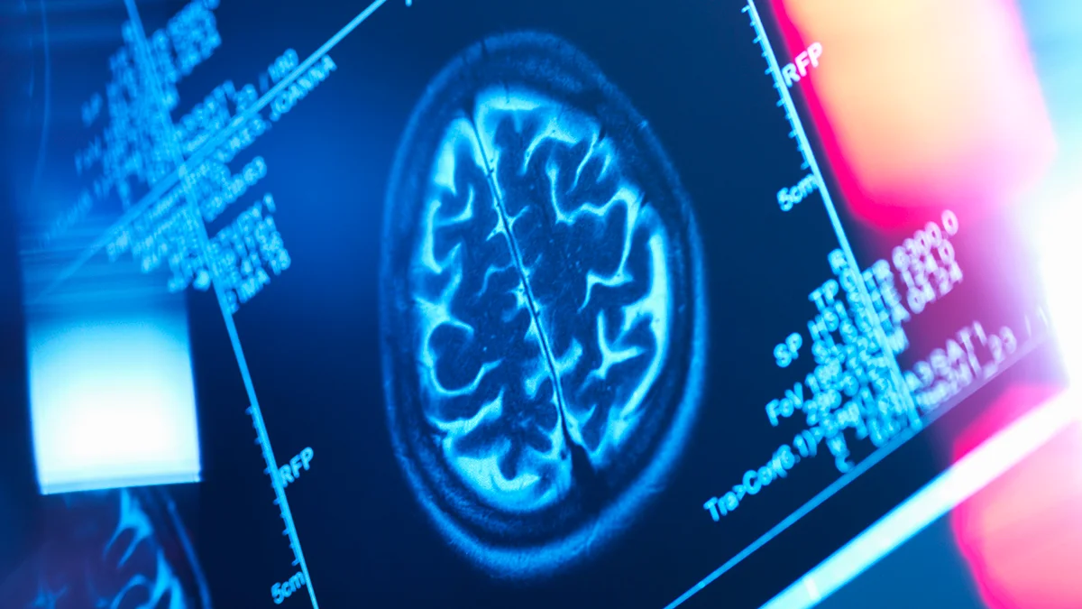Where Fat Hangs Out Predicts Brain Aging Risk