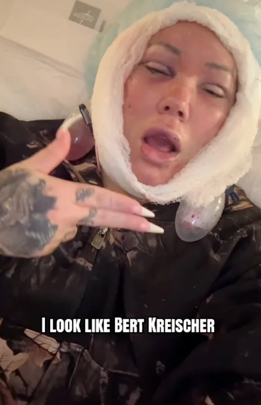 Jelly Roll’s Wife Walks Back Bert Kreischer Facelift Jest After Bus Fire