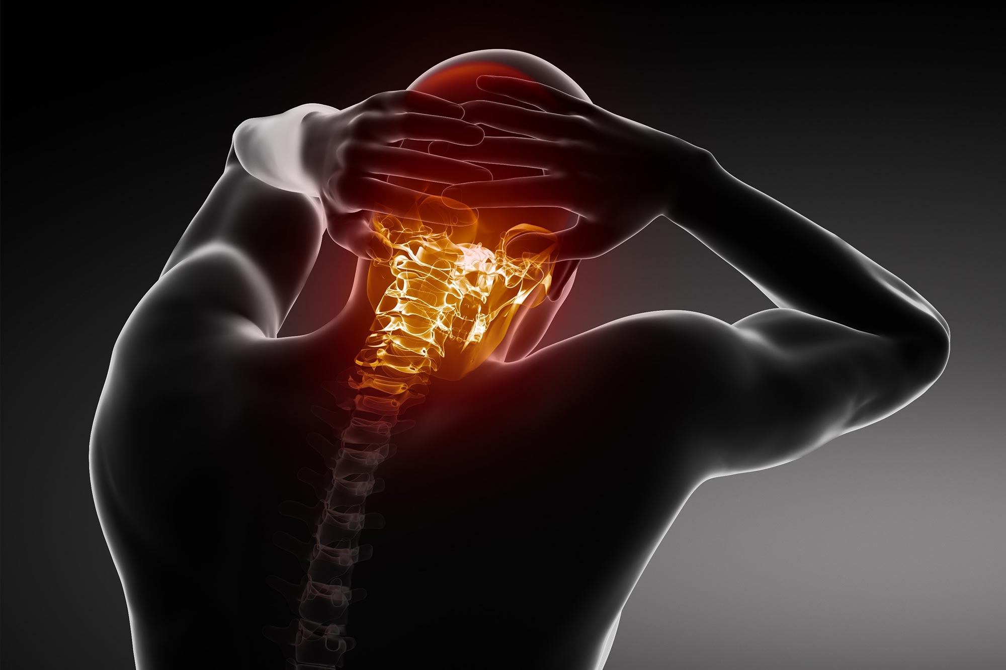 Featured image for "The Link Between Neck Inflammation and Headaches"