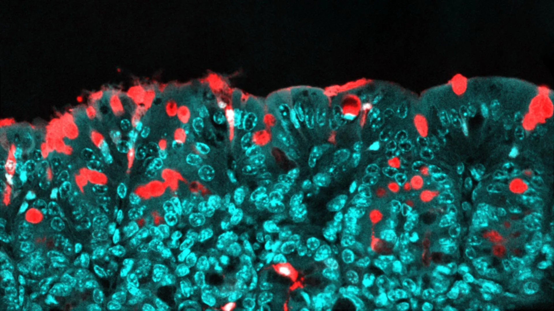 Featured image for Key Food Ingredient Influences Children's Long-Term Health