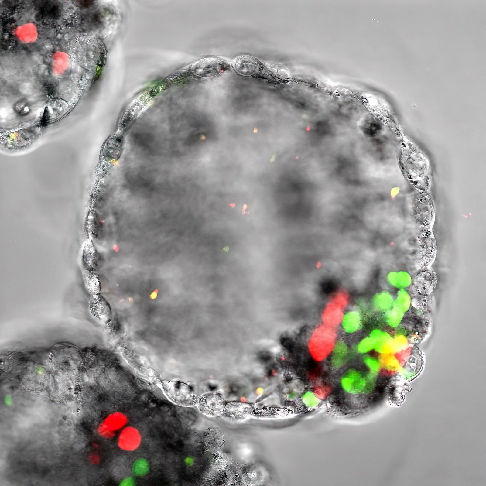 Featured image for Uncovering Hidden Mitochondrial DNA Mutations: New Research Insights.