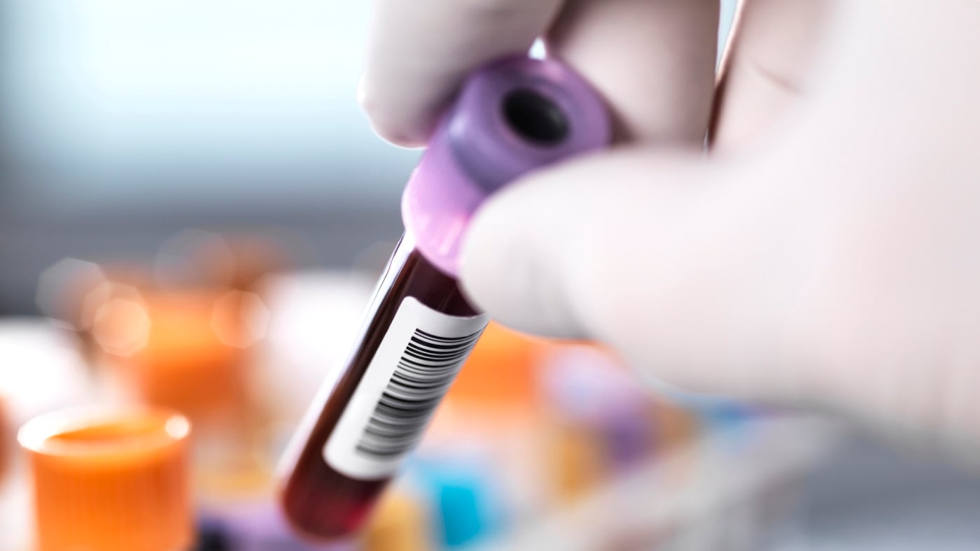 Featured image for One-Time CRISPR Treatment Significantly Lowers Cholesterol Levels