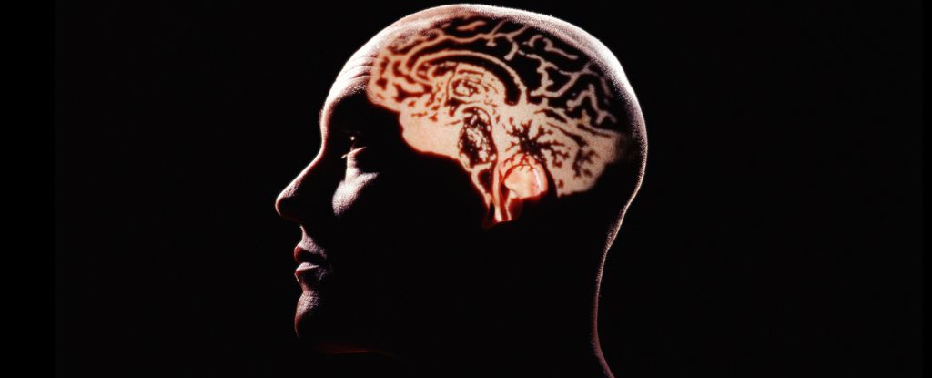 Featured image for "Unveiling the Disturbing Bias in Brain Aging Research: Grave Consequences"