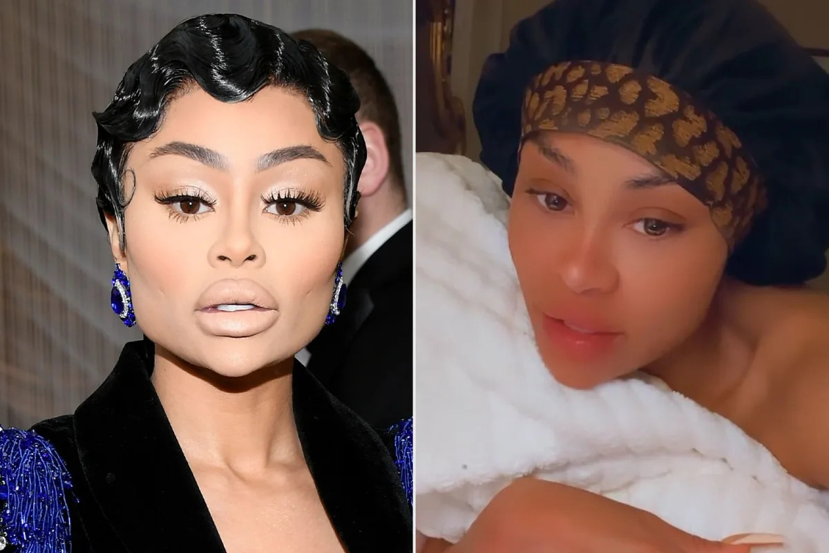 Blac Chyna's Reflection on Her Past "Crazy" Face After Removing Fillers