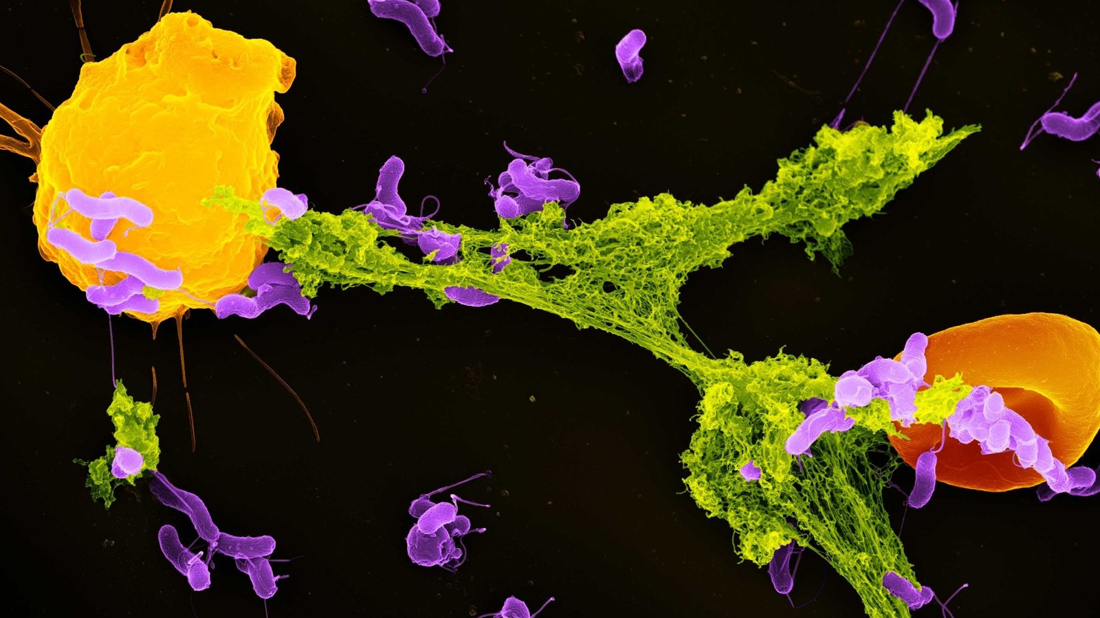 Featured image for Mitochondria: Beyond Powerhouses, They Fight Germs
