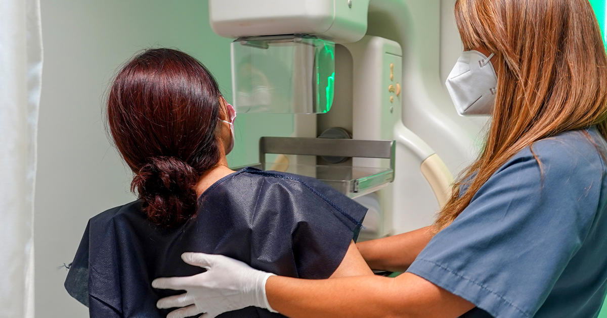 New guidelines recommend starting mammograms at age 40 for breast cancer screenings.