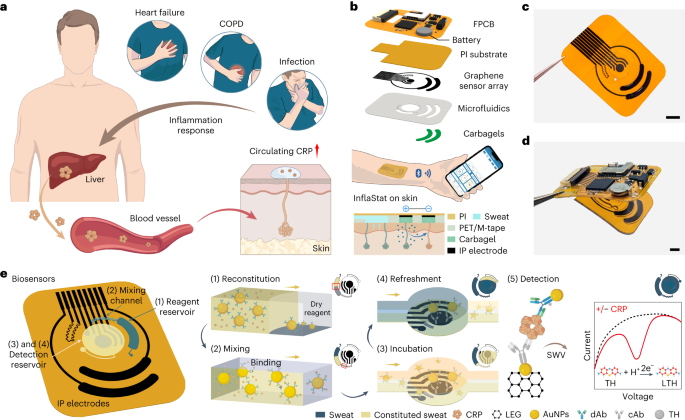 Featured image for Wireless Patch Monitors C-Reactive Protein in Sweat.