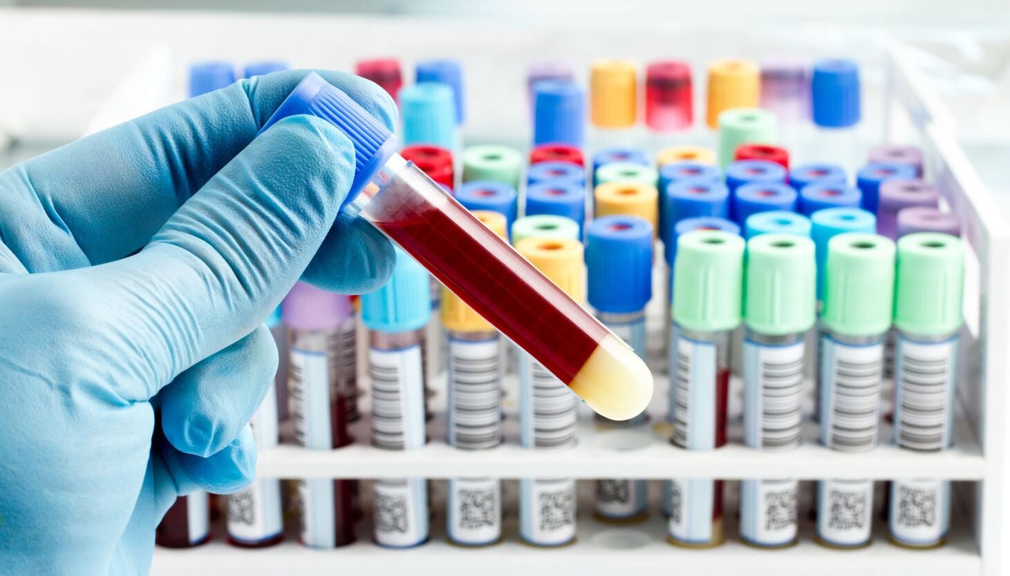 Featured image for "Revolutionary Blood Test Predicts Organ Aging and Disease Risk"