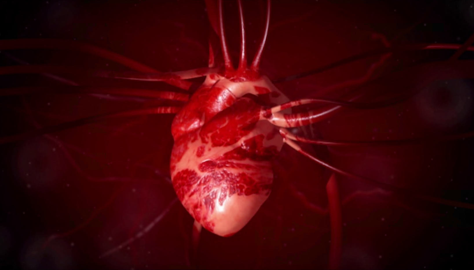 Featured image for Alarming Surge in Strokes Among Younger Adults