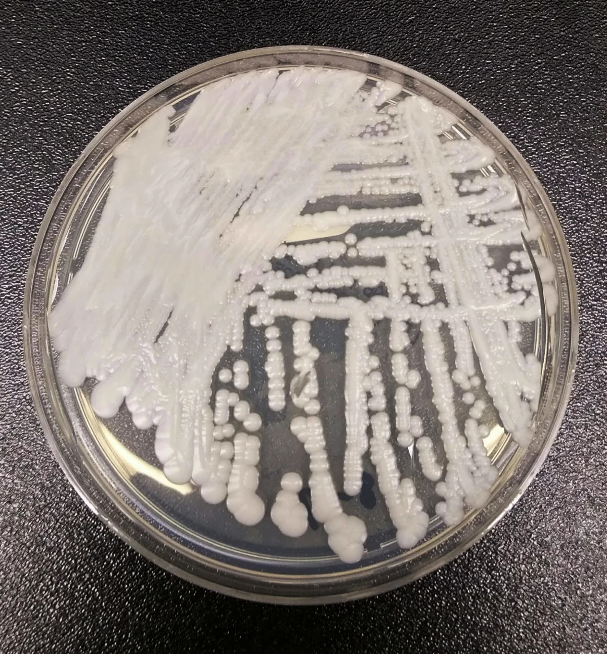 The Spread of Candida Auris Fungal Infection in the US and Canada.