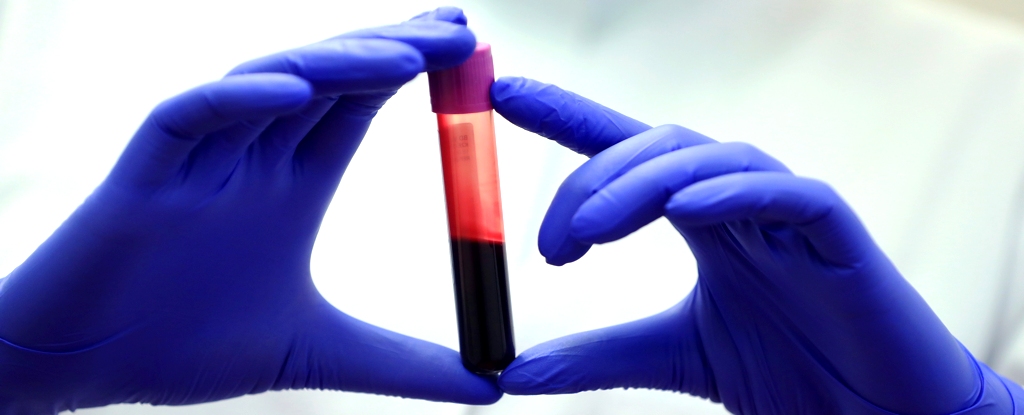 "Key Differences in the Blood of Exceptionally Long-Lived People"