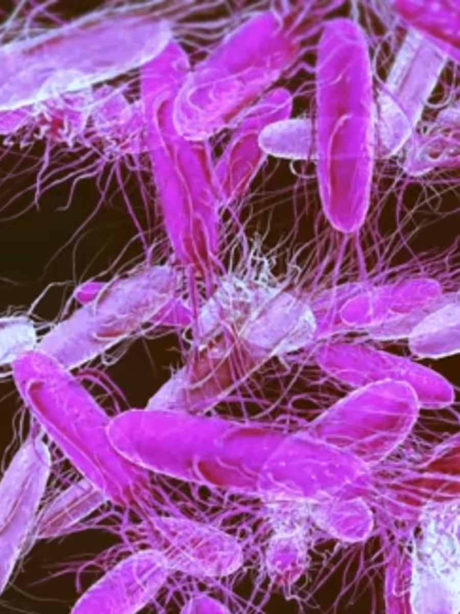 Featured image for Unexpected Foods That Can Cause Salmonella Illness