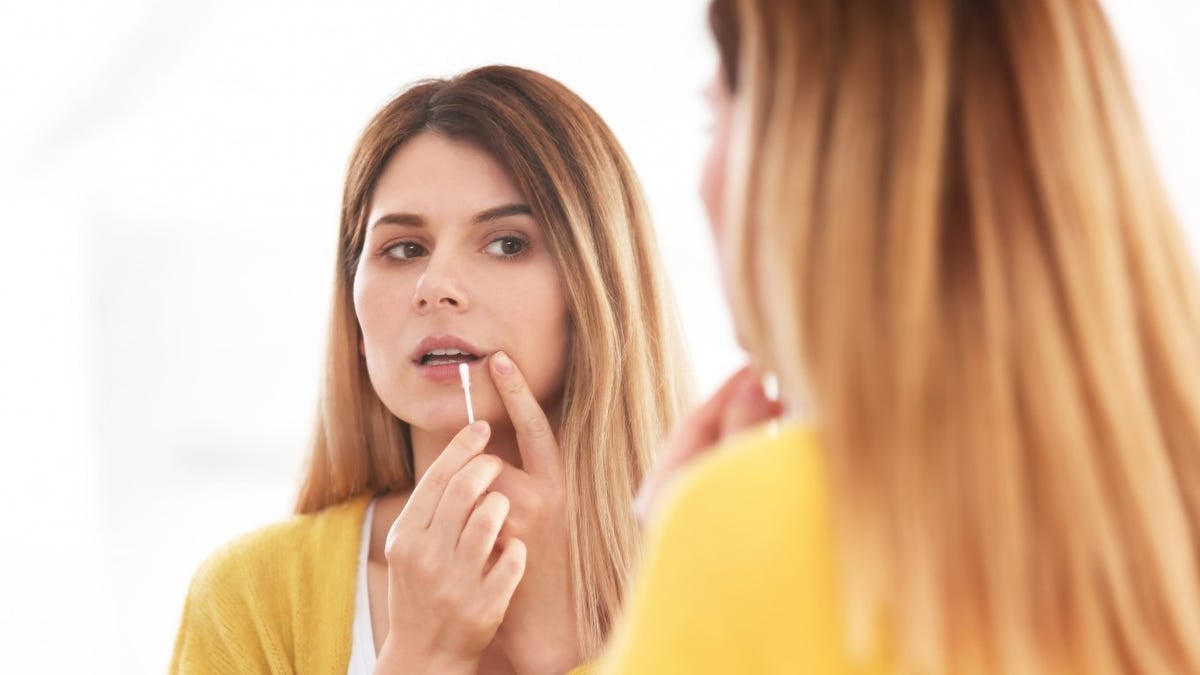 Featured image for Understanding and Treating Cold Sores: Expert Insights