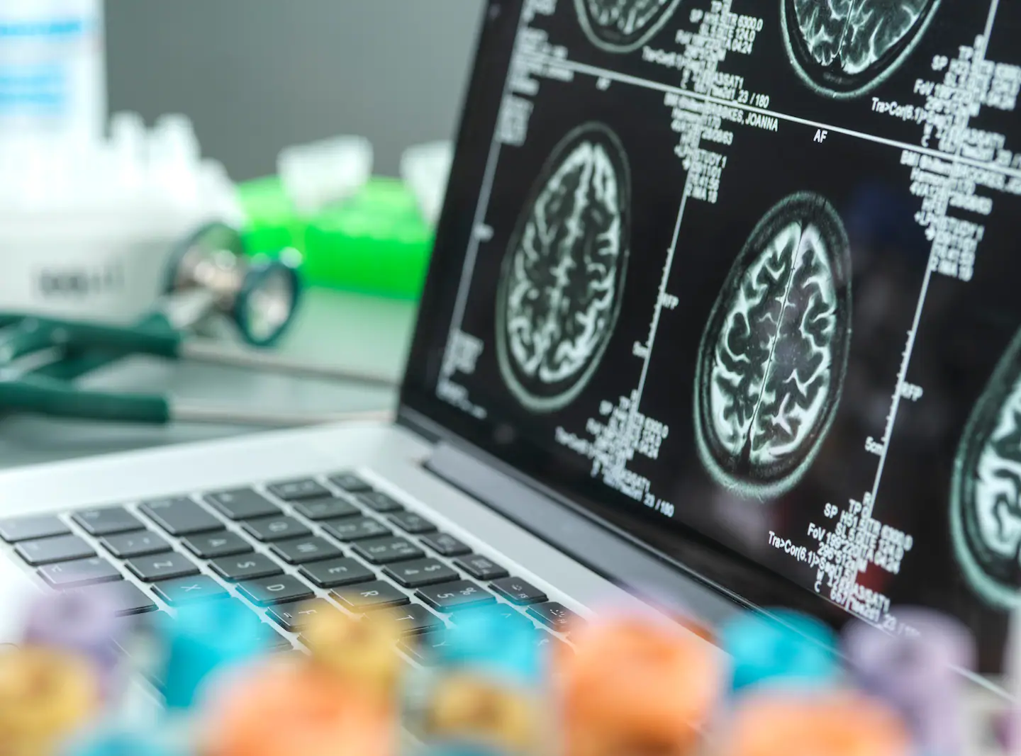 Featured image for New Blood Test Offers Early Detection of Alzheimer’s Disease