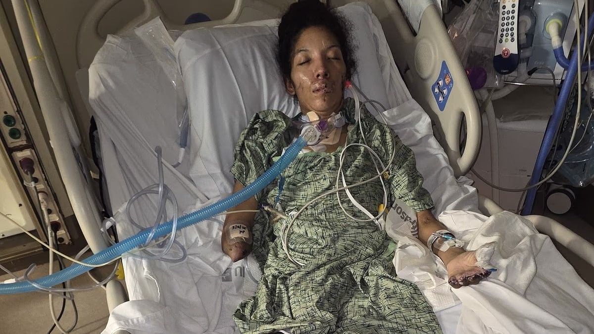 Featured image for Mother wakes up to find all limbs amputated after dual infections