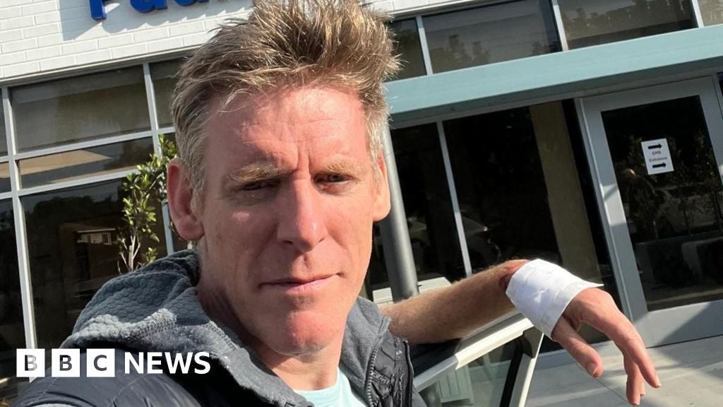 Featured image for Survivor recounts shark attack during swimming event