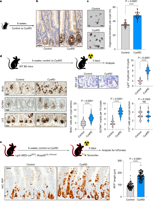 Featured image for Cysteine-Rich Diet Boosts Intestinal Healing and Regeneration