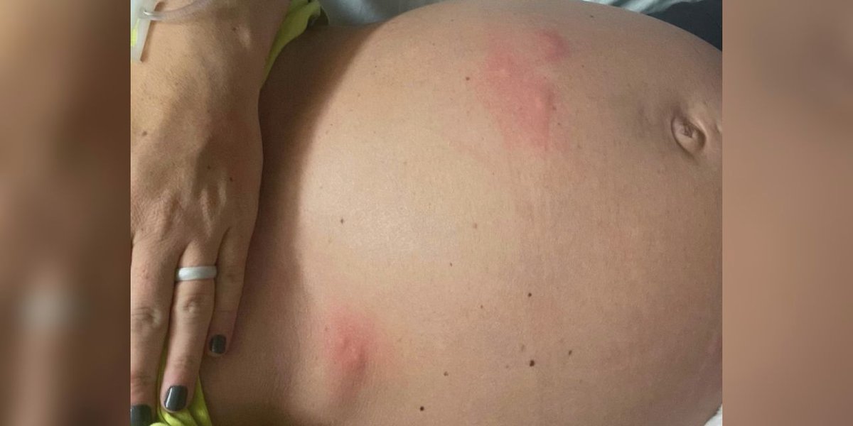 Featured image for "Infestation Nightmare: Bed Bugs Invade Hospital Delivery Room, Sioux Falls Mom's Ordeal"