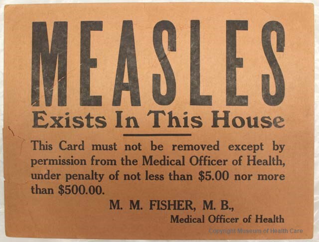 "Friday Musings: Adult Onset Measles"