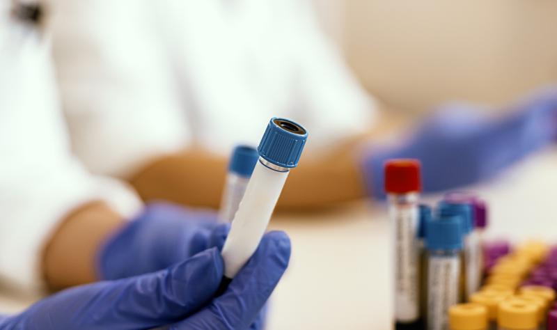 Featured image for "Blood Signals of Long COVID Uncover Potential Treatments"