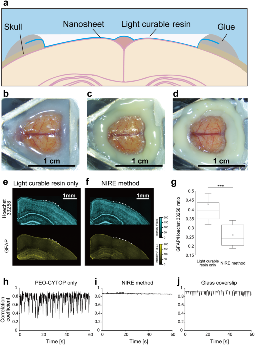 Featured image for "Fluoropolymer Nanosheet Enables Large-Scale In Vivo Mouse Brain Imaging"