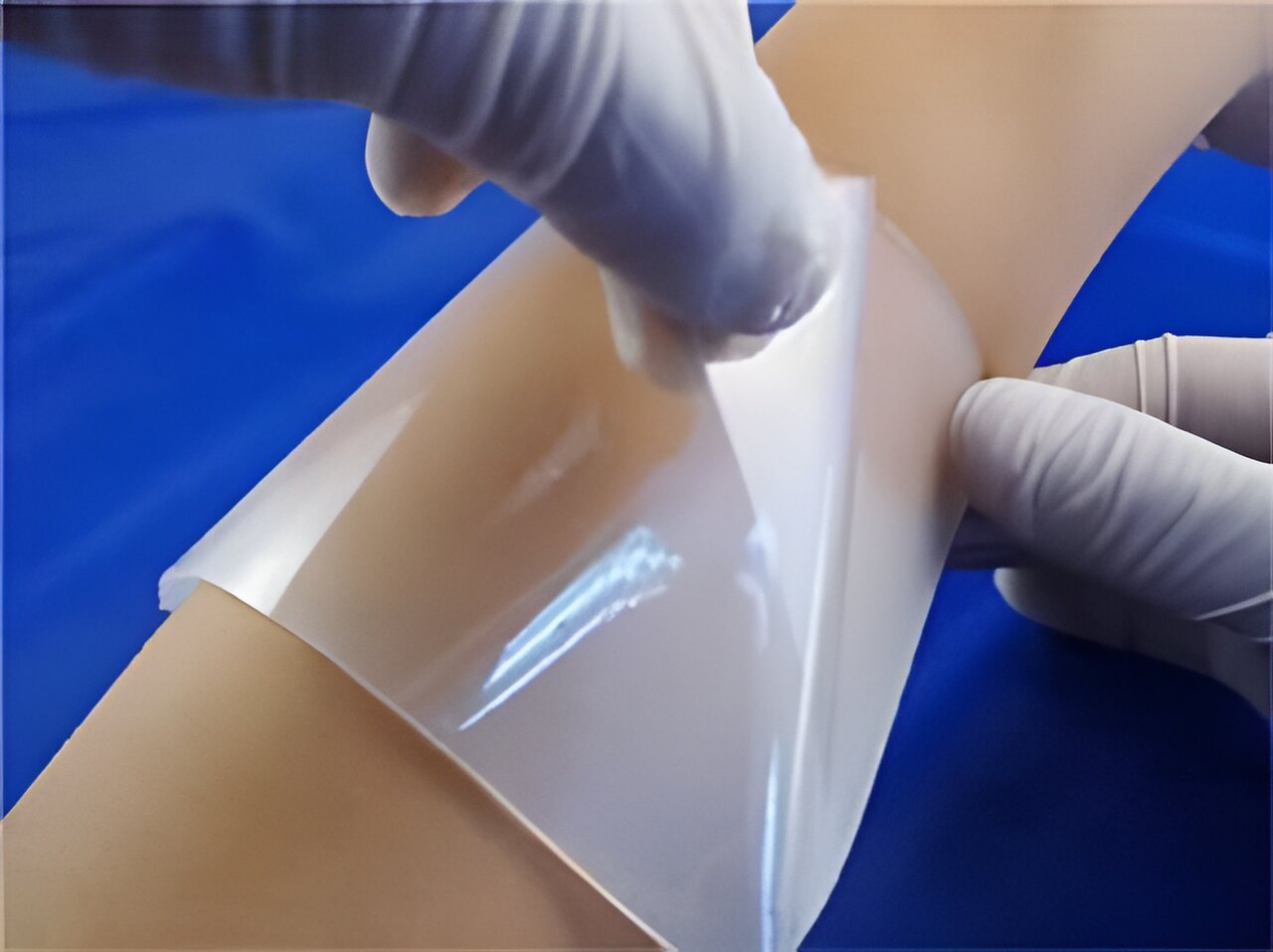 Featured image for "Revolutionary Hydrogels: Advancements in Wound Management Unveiled"