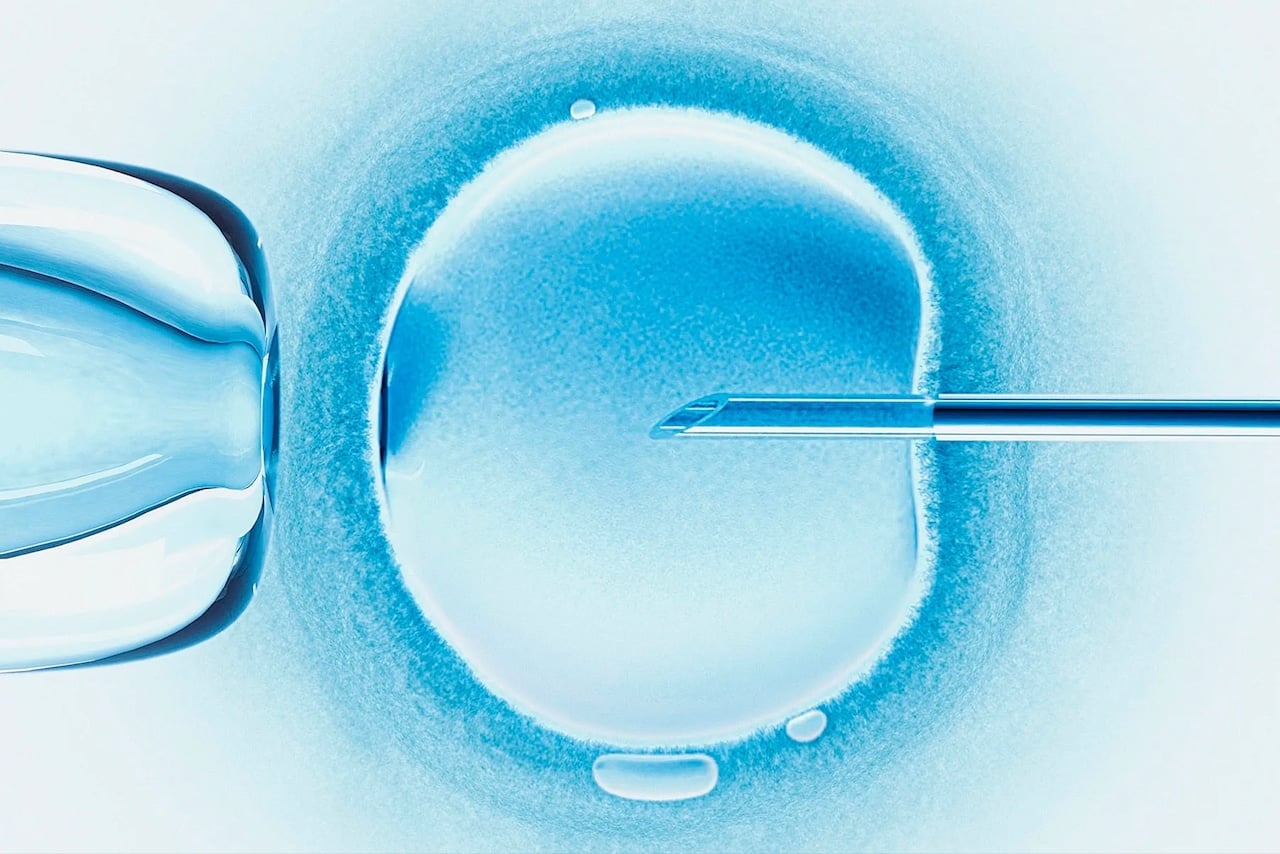 Featured image for "Alabama Hospital Ceases IVF Treatments Amid Litigation Concerns"