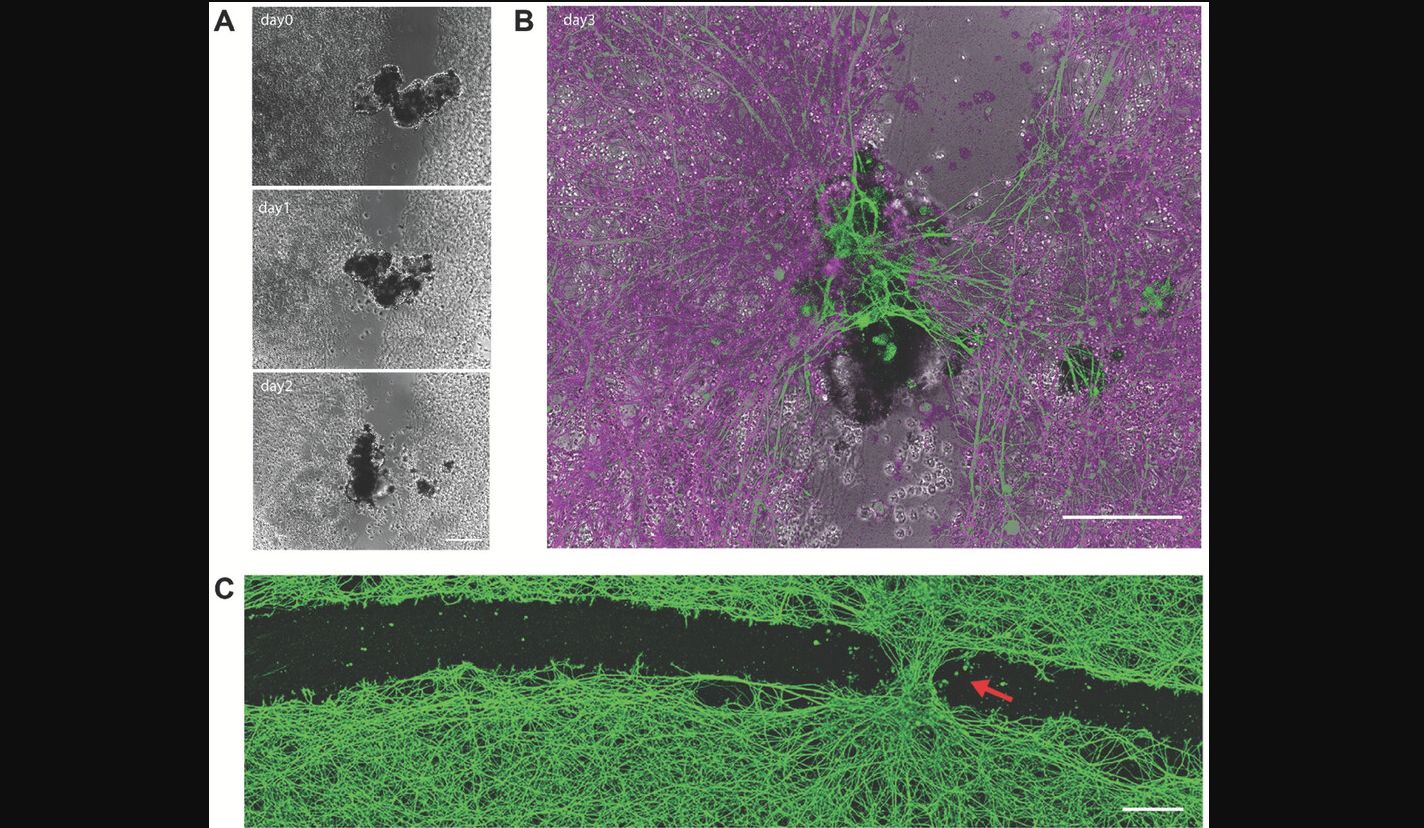 Featured image for Tiny Anthrobots: Human Cell-Based Robots Repair Neural Damage