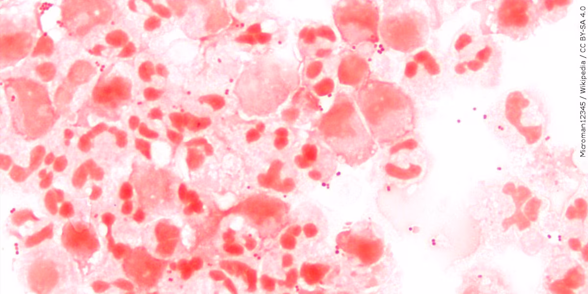 Meningococcal Disease Outbreak Declared by Virginia Department of Health