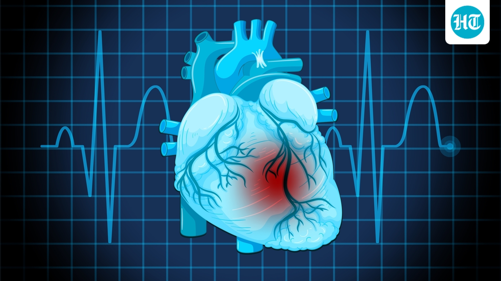 Featured image for Top Indicators and Lifestyle Tips to Prevent Heart Attacks in Young Adults