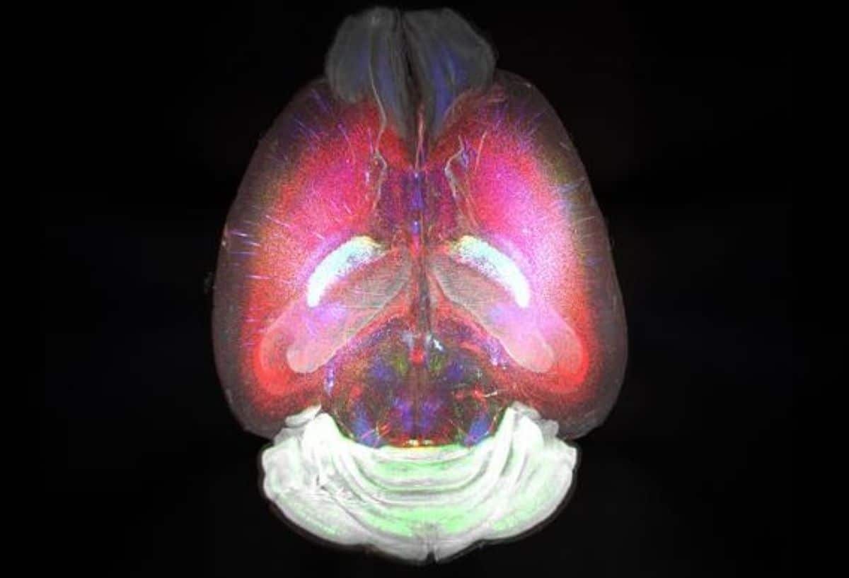 Featured image for 3D RNA Imaging Transforms Brain Study Techniques