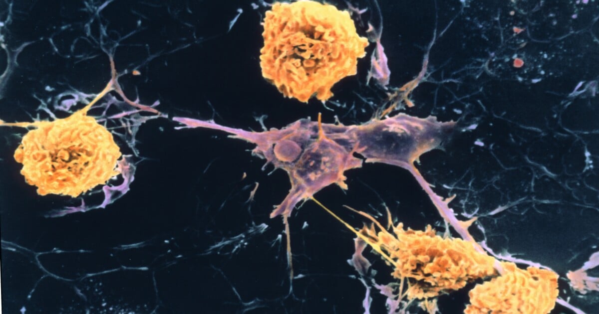 Featured image for Emerging MS Research and Dental Care Concerns