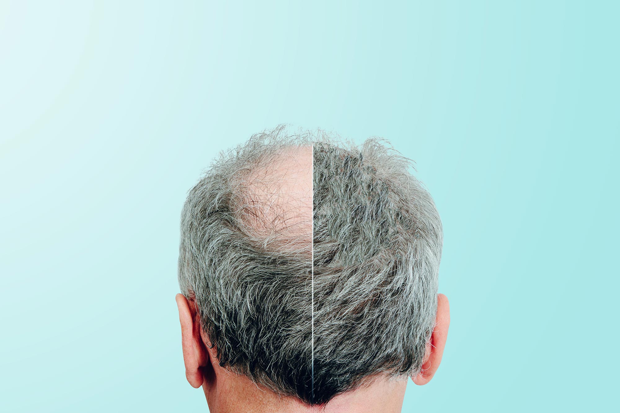 Featured image for Sweetener Derived from Stevia Promises New Hope for Hair Regrowth