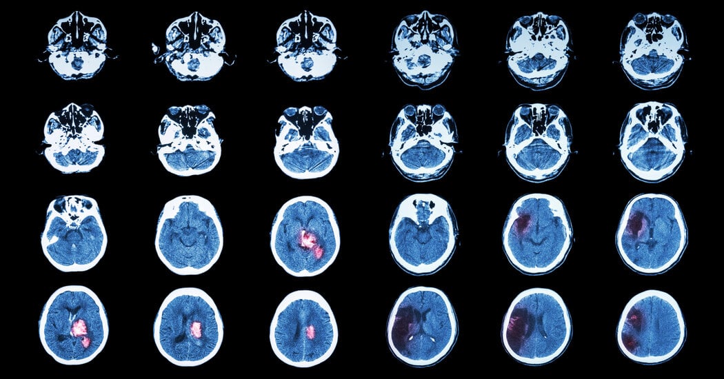 Featured image for Three Psychiatric Tools to Enhance Brain Healing