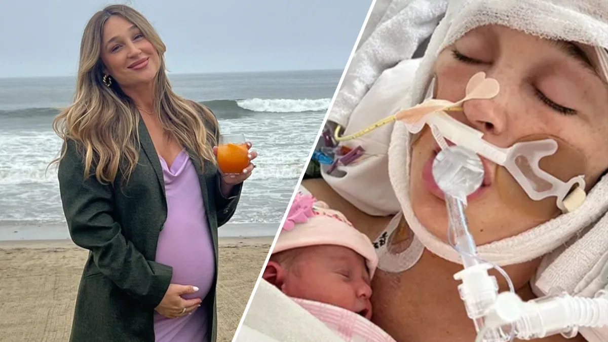 Pregnant Influencer Jackie Miller James in Coma After Aneurysm Rupture.