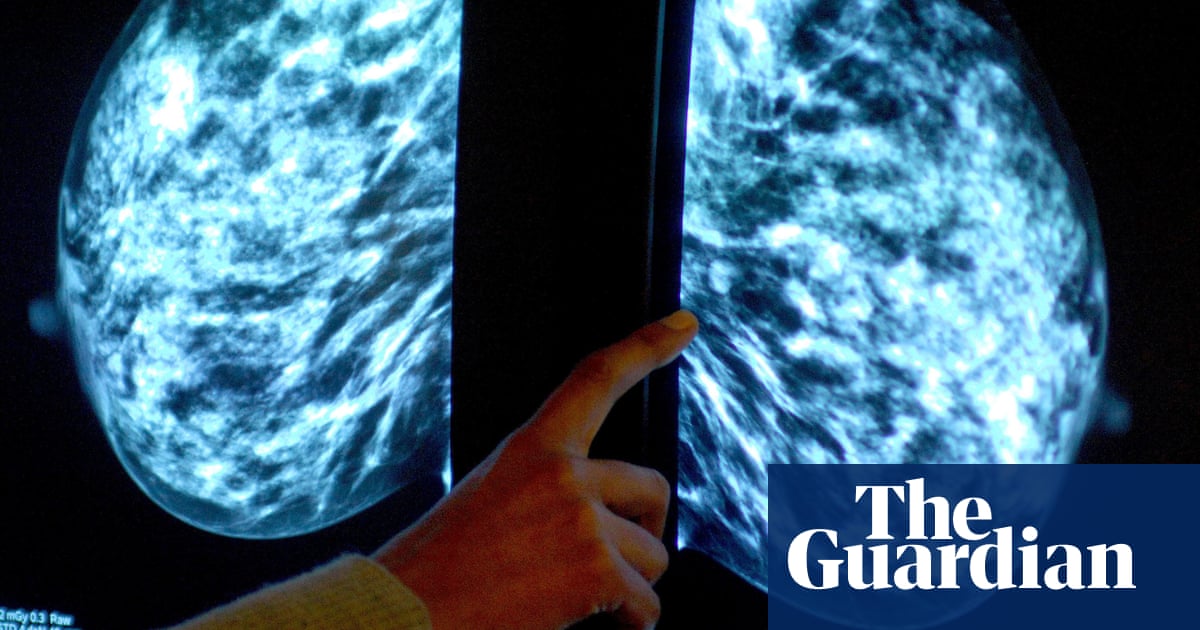 "UK Scientists Develop Bra-Fitted Device for Monitoring Breast Cancer Tumors"