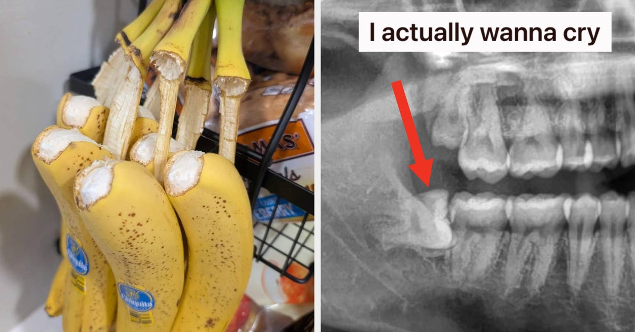 Featured image for 15 Unbelievable and Awful Things That Actually Happened to People