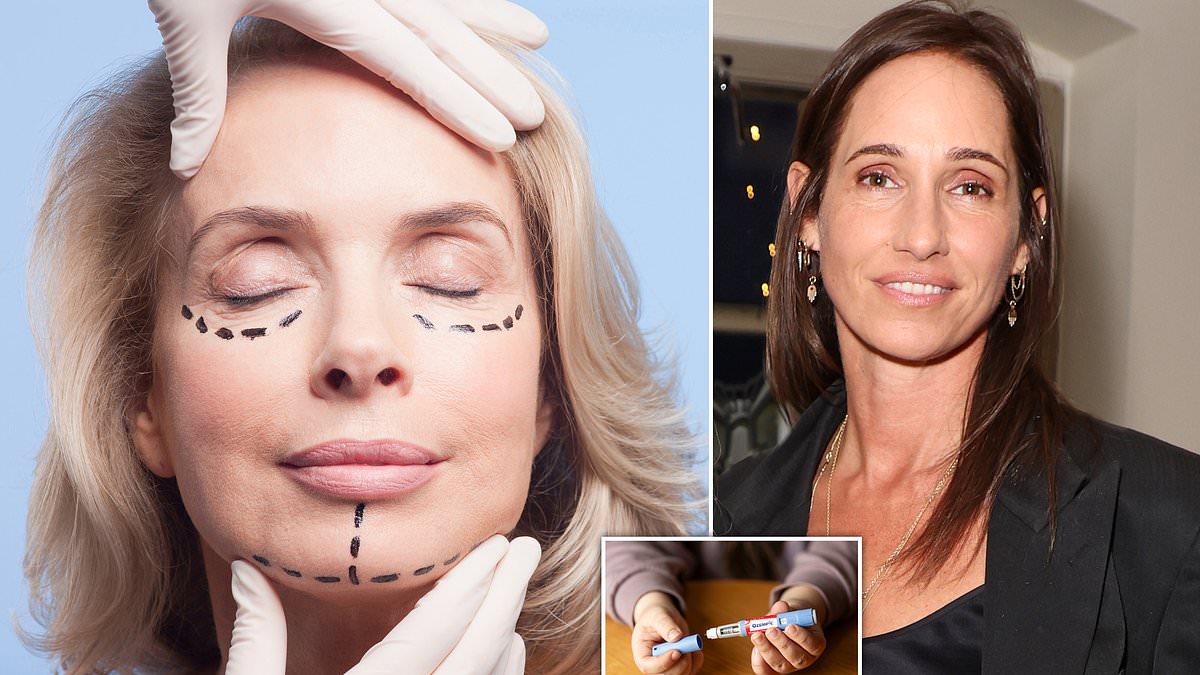 "Rising Concerns Over 'Ozempic Face' Among Women"