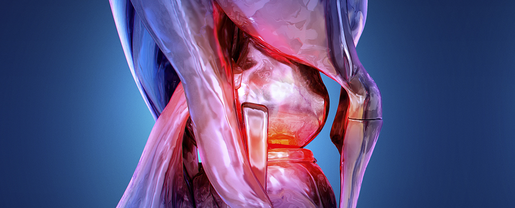 Featured image for Early Indicators of Rheumatoid Arthritis Identified Before Symptoms