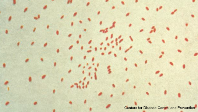 Whooping Cough Cases Surge Across Multiple States