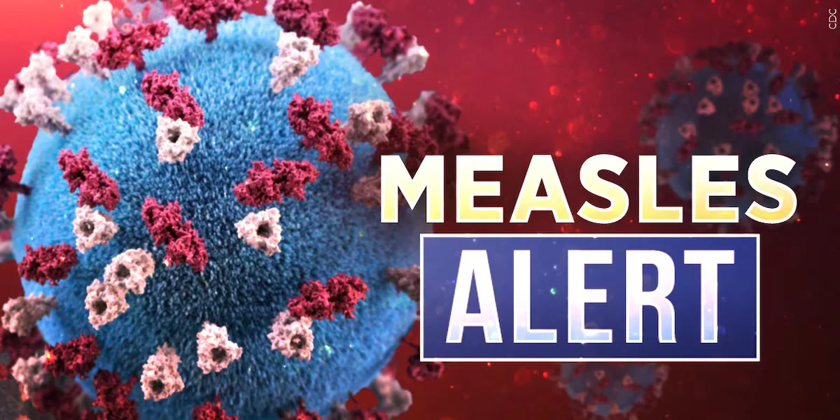 Measles Outbreak Confirmed in Platte County, Nebraska
