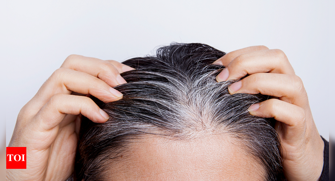 Featured image for "Unveiling the Lifestyle Factors Behind Premature Greying of Hair"