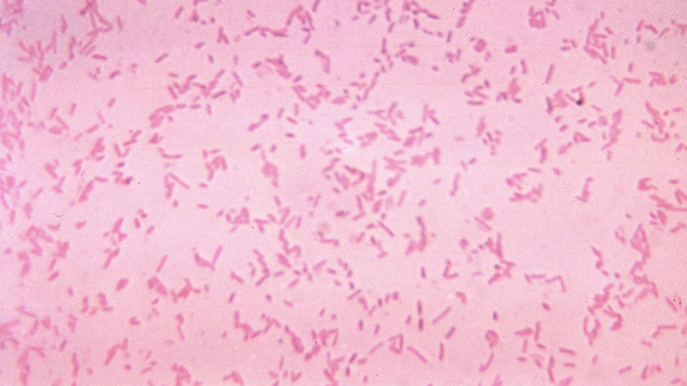 Featured image for WHO warns of rapid rise in drug-resistant infections threatening global health