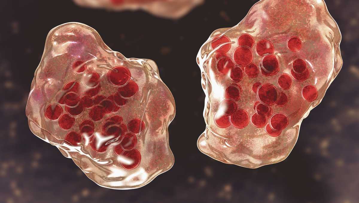 Featured image for "Measles Exposure Alert at Heritage Bank Center, Cincinnati Health Department Warns"