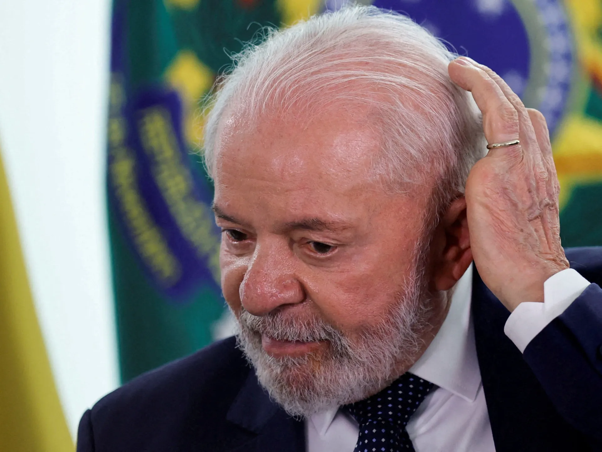Brazil's President Lula Stable, Faces Second Surgery After Brain Bleed