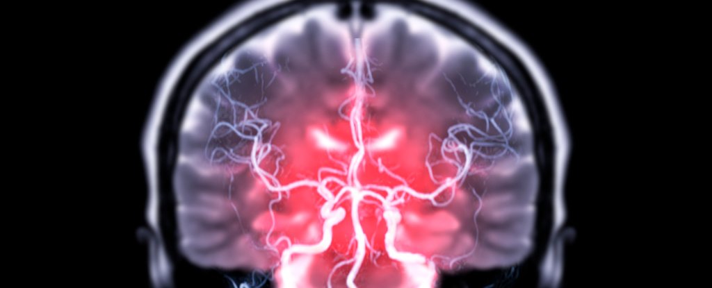 "Insights into the Brain's Reading Networks from Games and Studies"